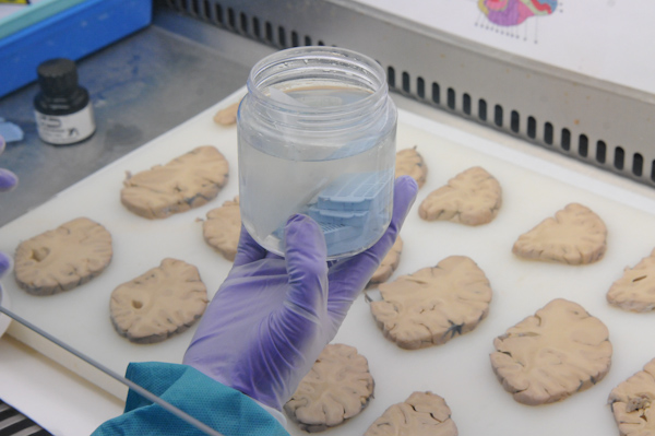 Brain samples being dissected